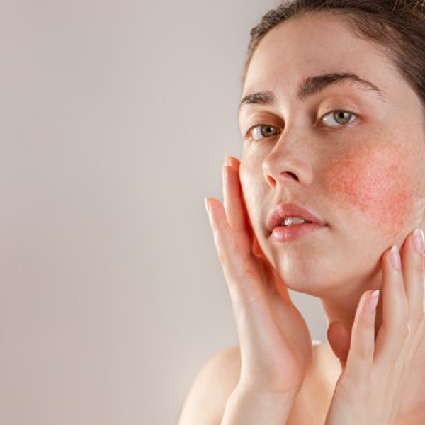 ASK DARON: Redness | Sensitivity